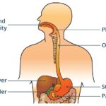 Diagram illustrating gastroesophageal reflux disease, showing stomach acid flowing back into the esophagus.