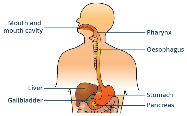 Diagram illustrating gastroesophageal reflux disease, showing stomach acid flowing back into the esophagus.