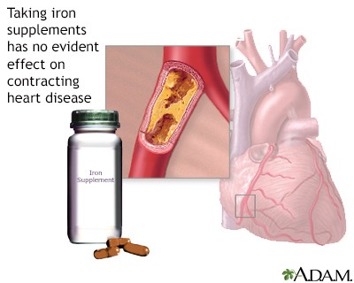 Variety of iron-rich heme food sources including beef, liver, and oysters