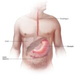 Senior woman having trouble swallowing