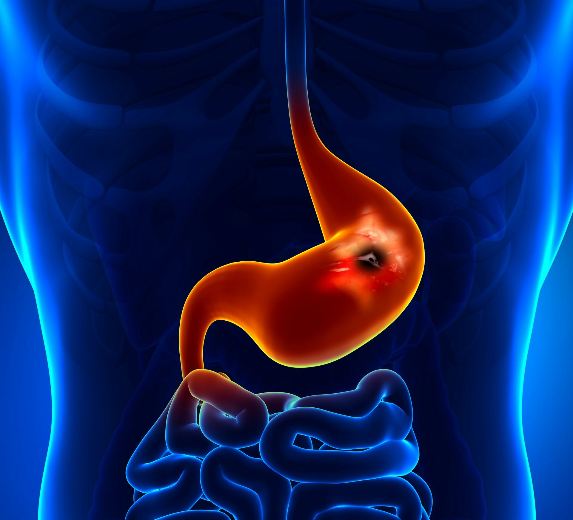 Foods that are gentle on the stomach